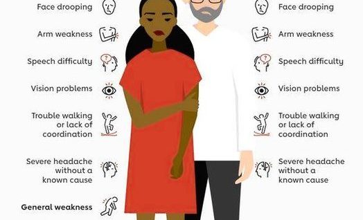 Stroke Symptoms Women vs Men