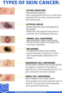 skin cancer – Charts