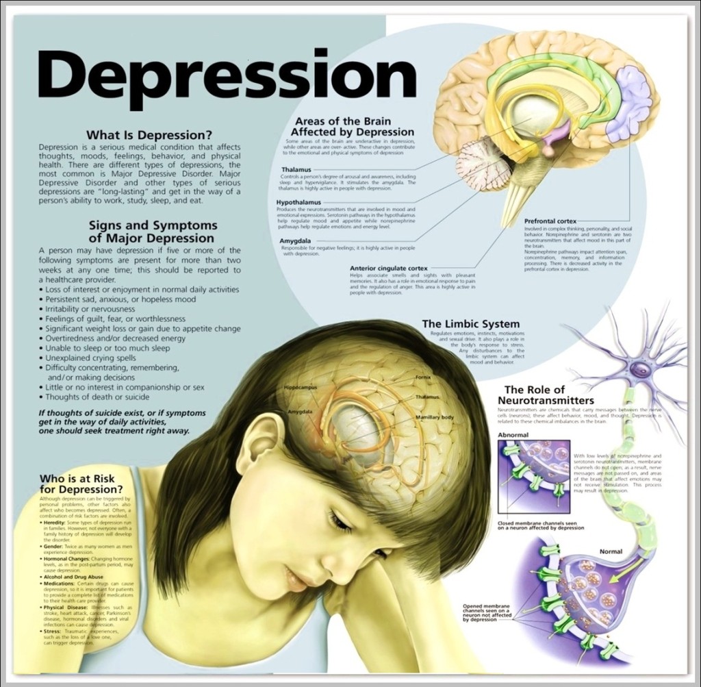 Depression Signs – Charts